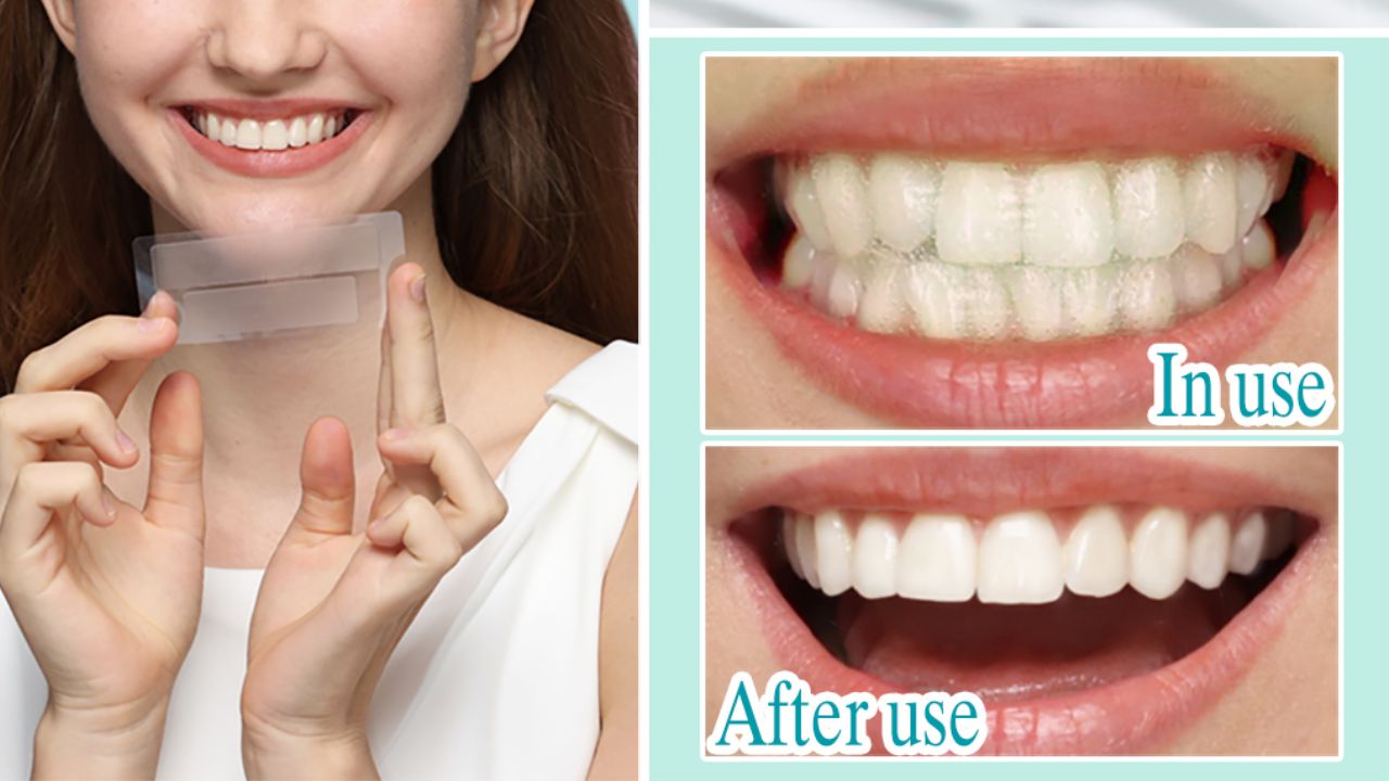 OEM/ODM Services for Teeth Whitening Products: Individualization and Quality